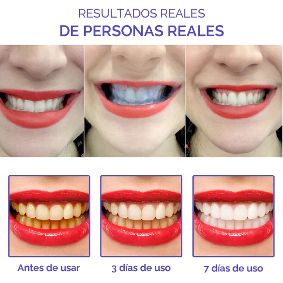 Kit Smile Kit: Blanqueador + Spray bucal