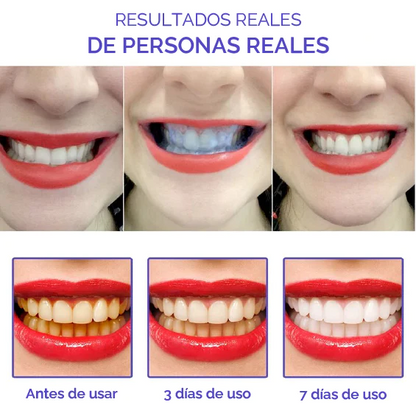 Kit Smile Kit: Blanqueador + Spray bucal